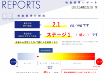 経営者が知っておきたいAGAリスク｜薄毛になる前に自分の身体を知る方法